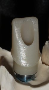 Individueller Implantataufbau Zirkonoxid